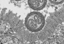 LA CICLOSPORIASIS: ¿CUÁLES SON SUS CAUSAS Y FORMAS DE CONTAGIO?